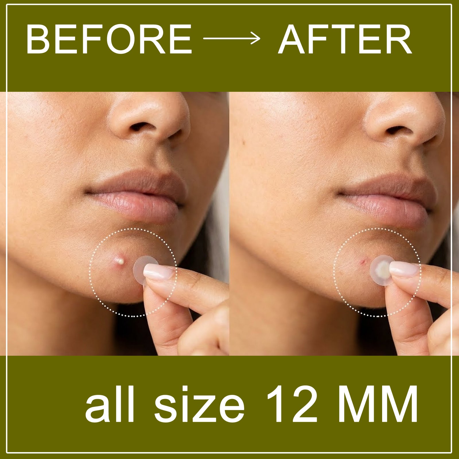 Before and After Results